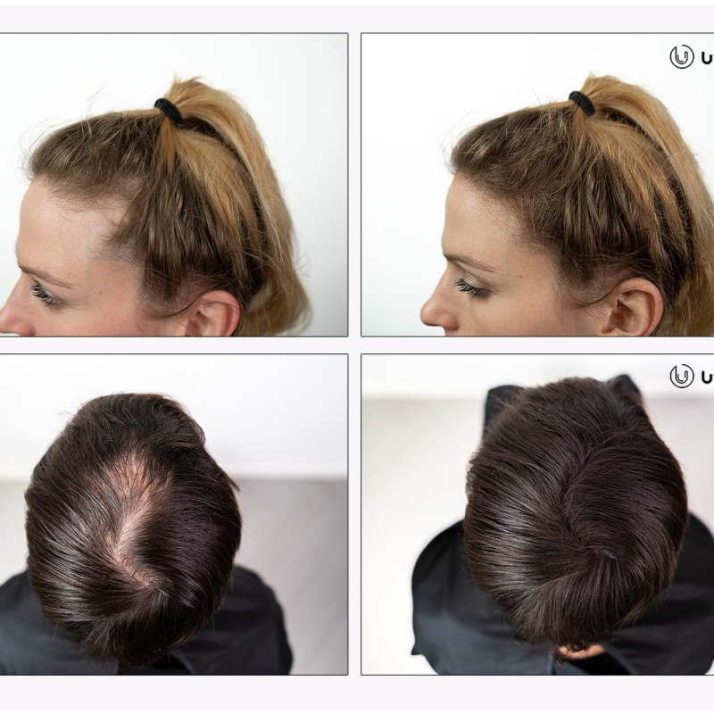 UVI Hair lasna vlakna, AUBURN / rdečkasta (veliki 27.5 g, do 50 nanosov) UVI Hair lasna vlakna, AUBURN / rdečkasta (veliki 27.5 g, do 50 nanosov)